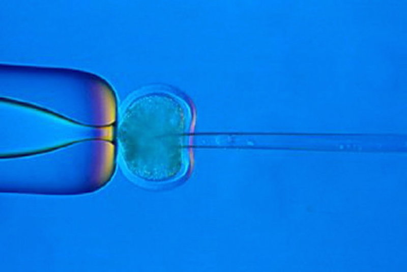 mitochondrial transfer
