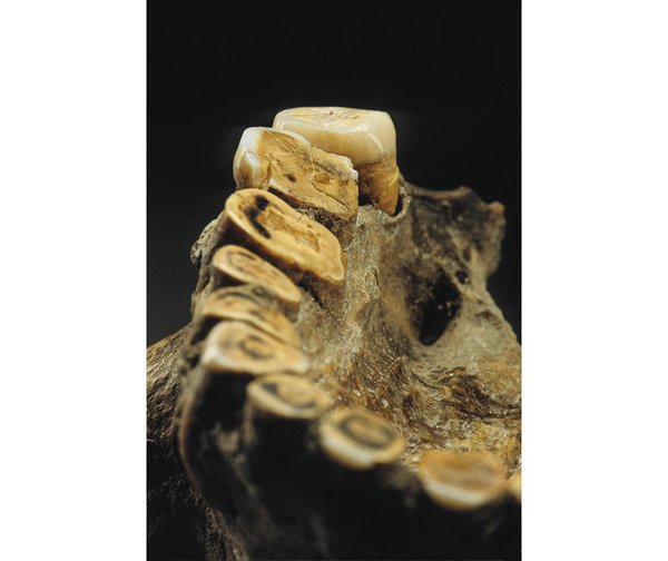 kennewick jaw