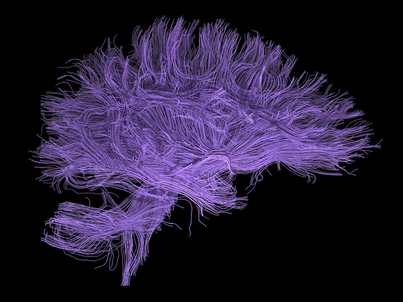 Betty Lee, White matter fibre tracts, 2011 Brain Art winner